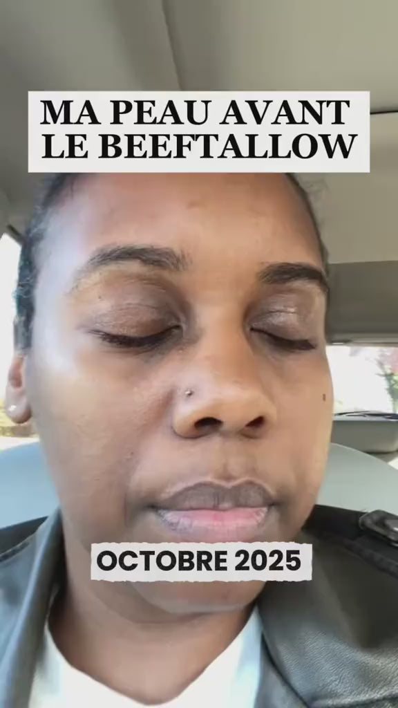 Vidéo
